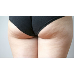 Complexe macérat de bourgeons BIO : Cellulite - DROMESSENCE